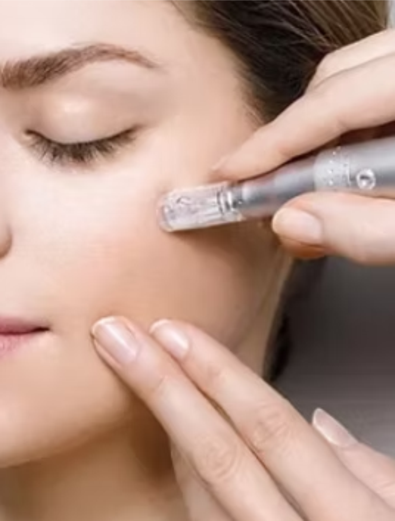Gesichtsbehandlung POWERNEDDLING BEAUTYZONE KEMPTEN Gesichtsbehandlung POWERNEDDLING BEAUTYZONE KEMPTEN