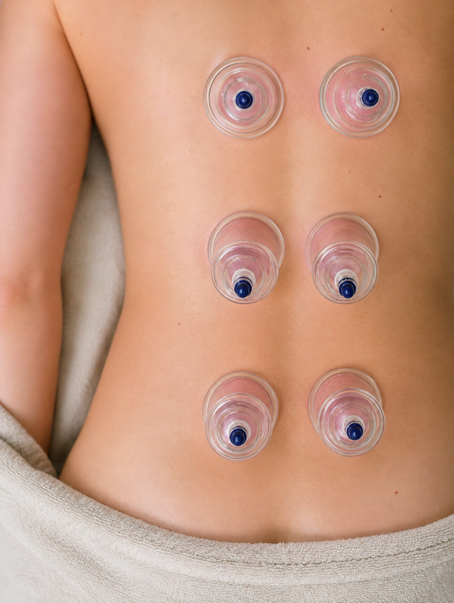 Breuss- & Schröpfmassage by BEAUTYZONE KEMPTEN Breuss- & Schröpfmassage by BEAUTYZONE KEMPTEN
