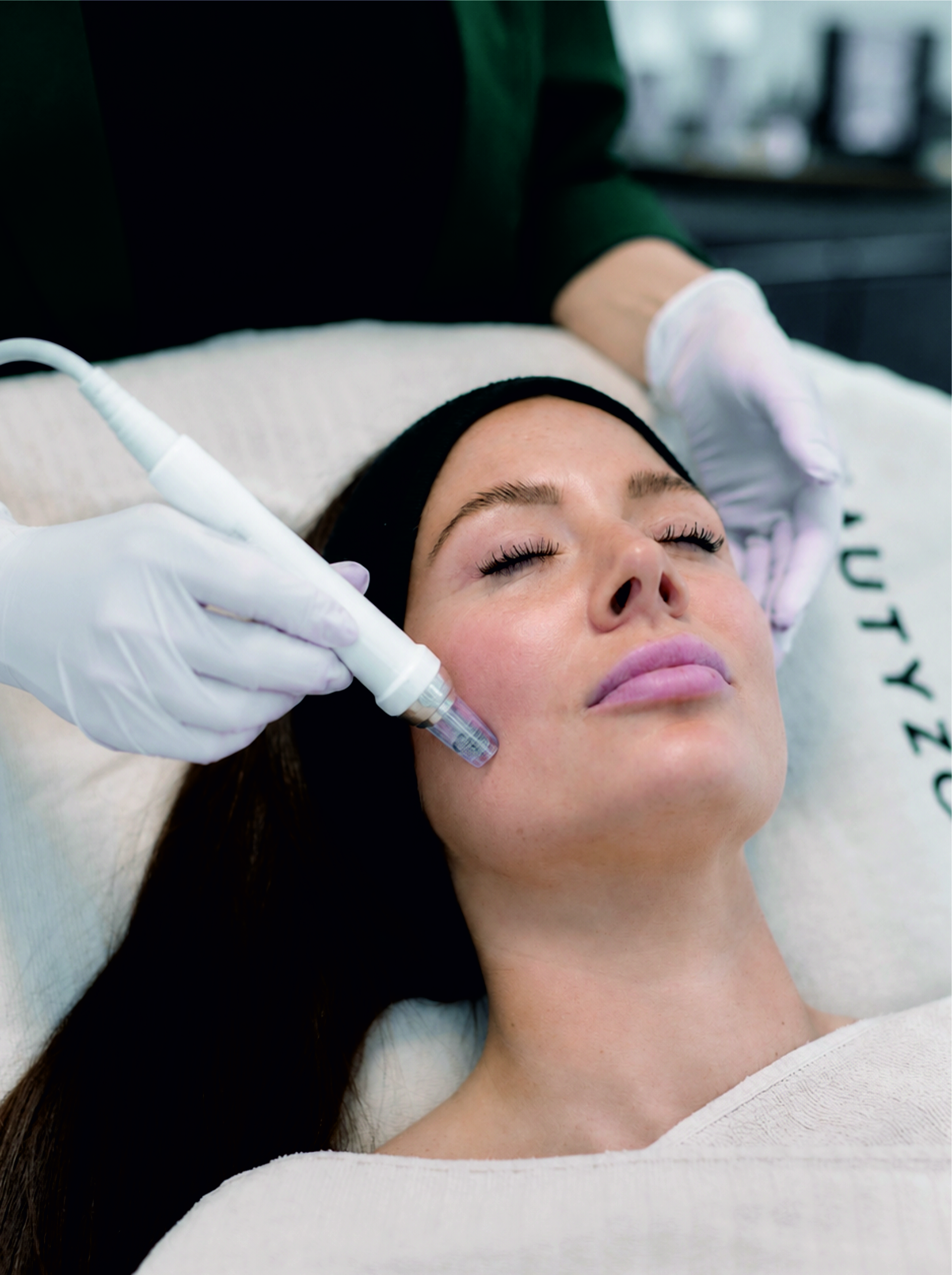 Gesichtsbehandlung Microdermabrasion BEAUTYZONE KEMPTEN Gesichtsbehandlung Microdermabrasion BEAUTYZONE KEMPTEN