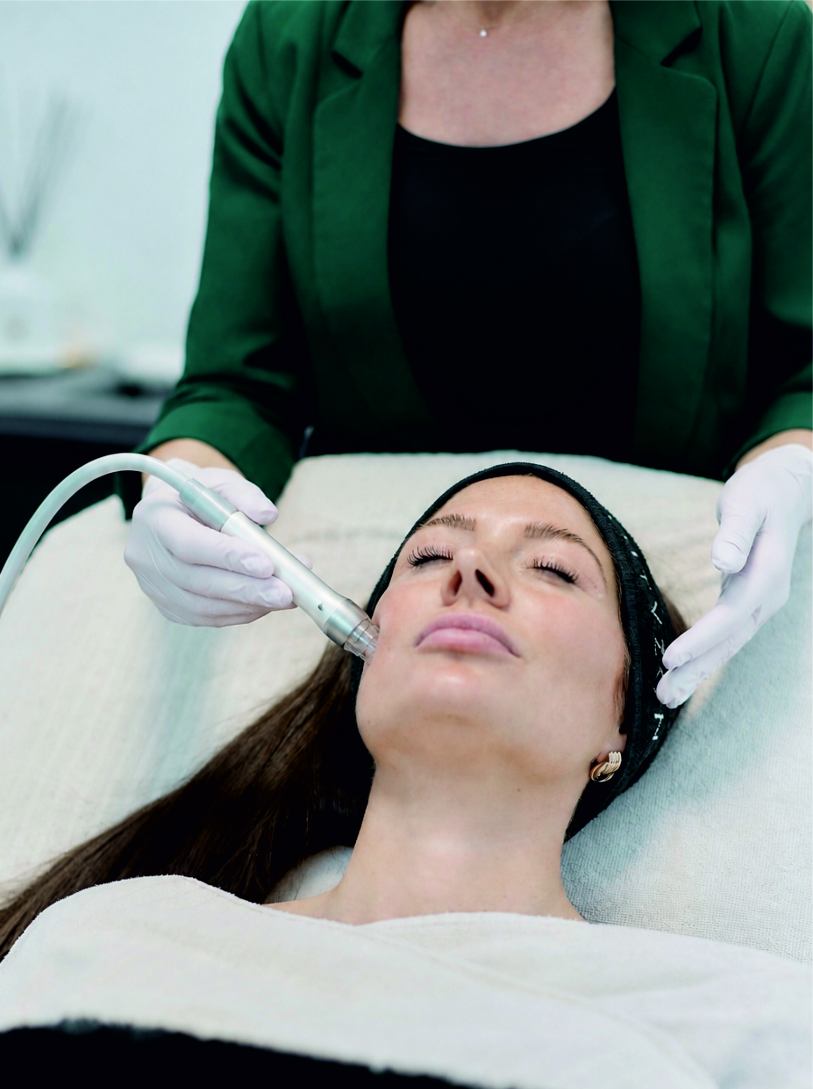 Gesichtsbehandlung Microdermabrasion Microneedling BEAUTYZONE KEMPTEN Gesichtsbehandlung Microdermabrasion Microneedling BEAUTYZONE KEMPTEN