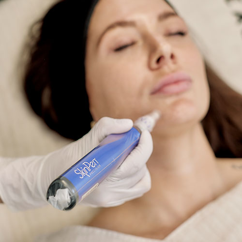 hydrafacial_skinpen
